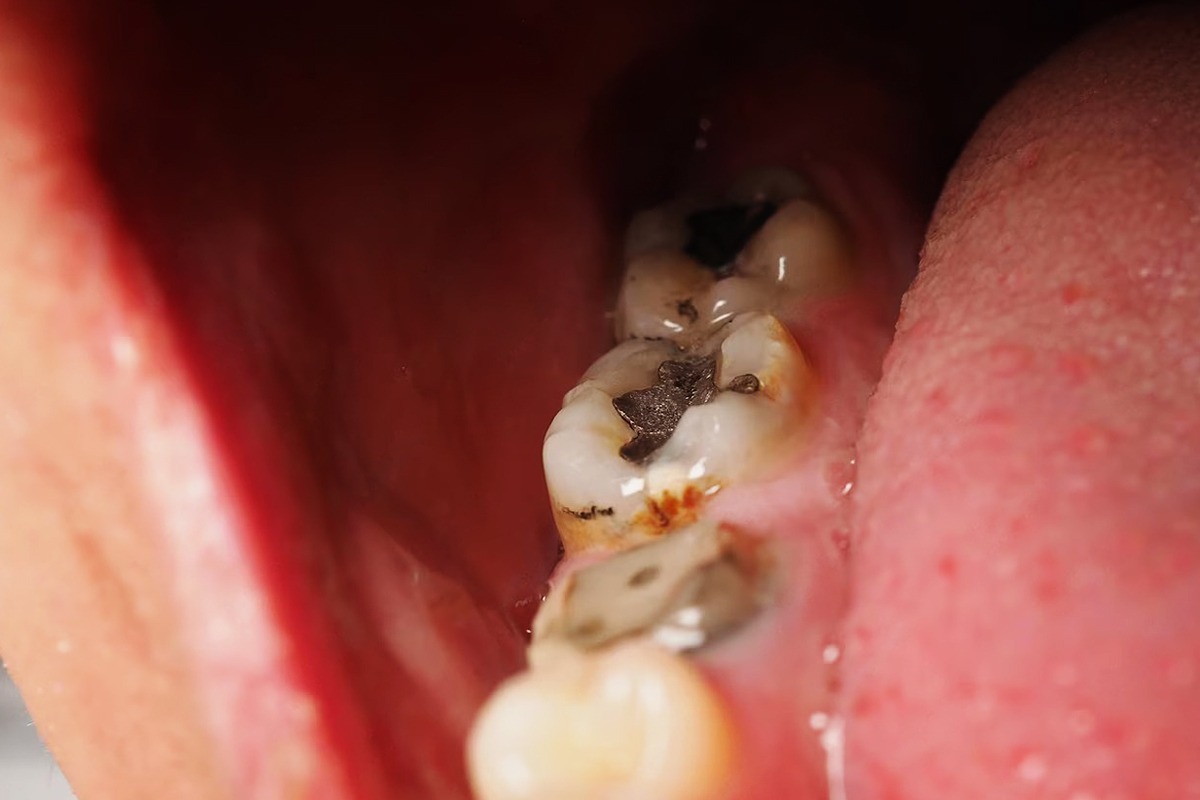 periodontics-hackney-wick