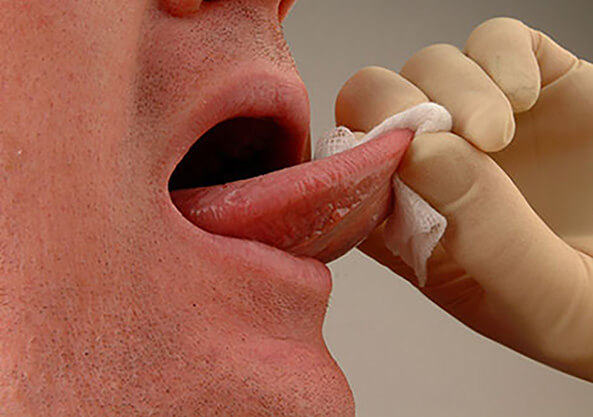 Mouth cancer soft tissue exam