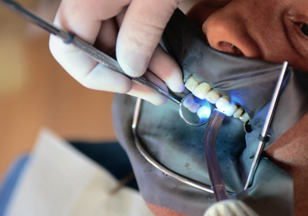 Root canal treatment